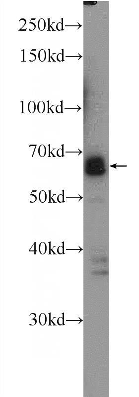 HeLa cells were subjected to SDS PAGE followed by western blot with Catalog No:115743(SUPT7L Antibody) at dilution of 1:600