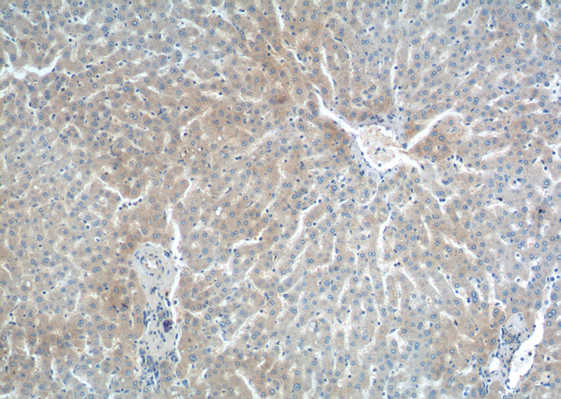 Immunohistochemistry of paraffin-embedded human liver tissue slide using Catalog No:109888(DENND1A Antibody) at dilution of 1:200 (under 10x lens).