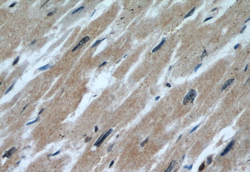 Immunohistochemical of paraffin-embedded human heart using Catalog No:108829(CALML6 antibody) at dilution of 1:50 (under 40x lens)