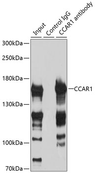 Immunoprecipitation - CCAR1 Polyclonal Antibody 