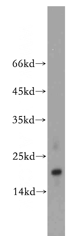 A2780 cells were subjected to SDS PAGE followed by western blot with Catalog No:116195(TMEM70 antibody) at dilution of 1:800