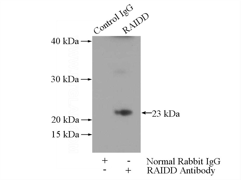 IP Result of anti-CRADD (IP:Catalog No:114528, 3ug; Detection:Catalog No:114528 1:1000) with mouse kidney tissue lysate 4000ug.