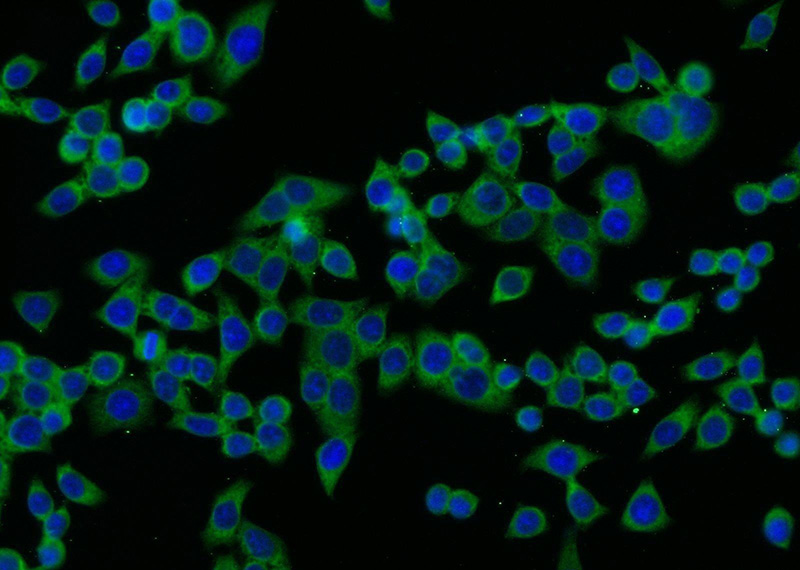 Immunofluorescent analysis of BxPC-3 cells using Catalog No:116326(TRIP10 Antibody) at dilution of 1:25 and Alexa Fluor 488-congugated AffiniPure Goat Anti-Rabbit IgG(H+L)