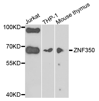 Western blot - ZNF350 Polyclonal Antibody 
