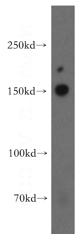 mouse brain tissue were subjected to SDS PAGE followed by western blot with Catalog No:112623(MINK1 antibody) at dilution of 1:300