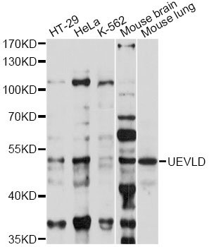 Western blot - UEVLD Polyclonal Antibody 