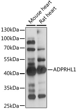 Western blot - ADPRHL1 Polyclonal Antibody 