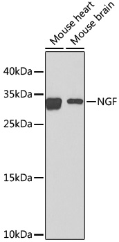 Western blot - NGF Polyclonal Antibody.Western blot analysis of extracts of various cell lines, using NGF antibody at 1:1000 dilution.Secondary antibody: HRP Goat Anti-Rabbit IgG (H+L) at 1:10000 dilution.Lysates/proteins: 25ug per lane.Blocking buffer: 3% nonfat dry milk in TBST.Detection: ECL Enhanced Kit .Exposure time: 60s.