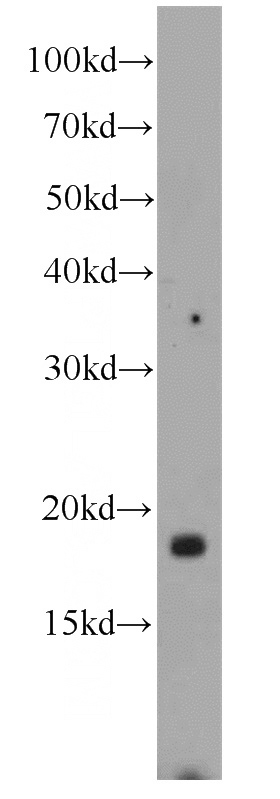 mouse brain tissue were subjected to SDS PAGE followed by western blot with Catalog No:112292(Loc286135 antibody) at dilution of 1:1000
