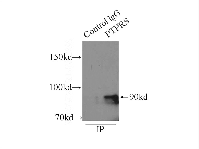 IP Result of anti-rPTPσ (IP:Catalog No:114330, 5ug; Detection:Catalog No:114330 1:400) with mouse brain tissue lysate 6500ug.