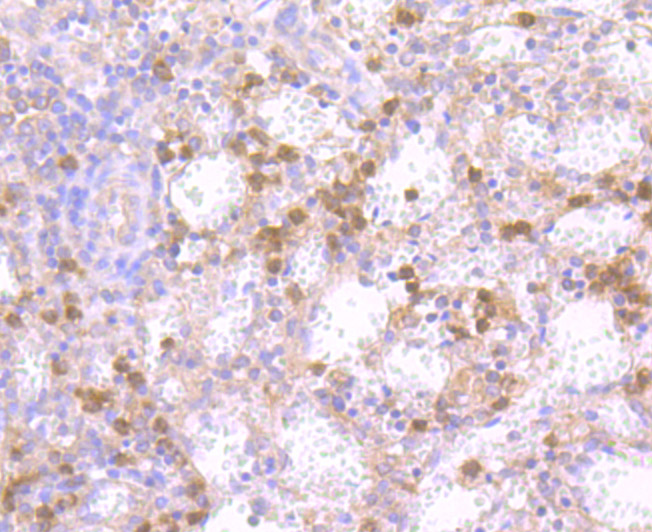 Fig5: Immunohistochemical analysis of paraffin-embedded human spleen tissue using anti-NLRC3 antibody. Counter stained with hematoxylin.