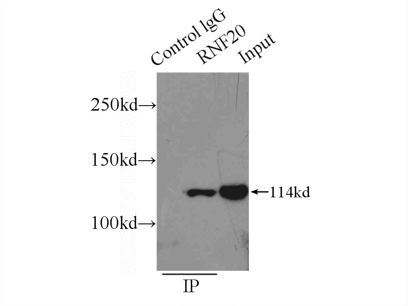 IP Result of anti-RNF20 (IP:Catalog No:114751, 3ug; Detection:Catalog No:114751 1:500) with HeLa cells lysate 2000ug.