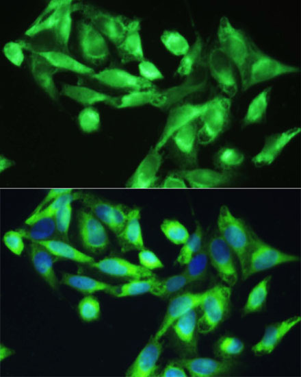 Immunofluorescence - CXCR5 Polyclonal Antibody 