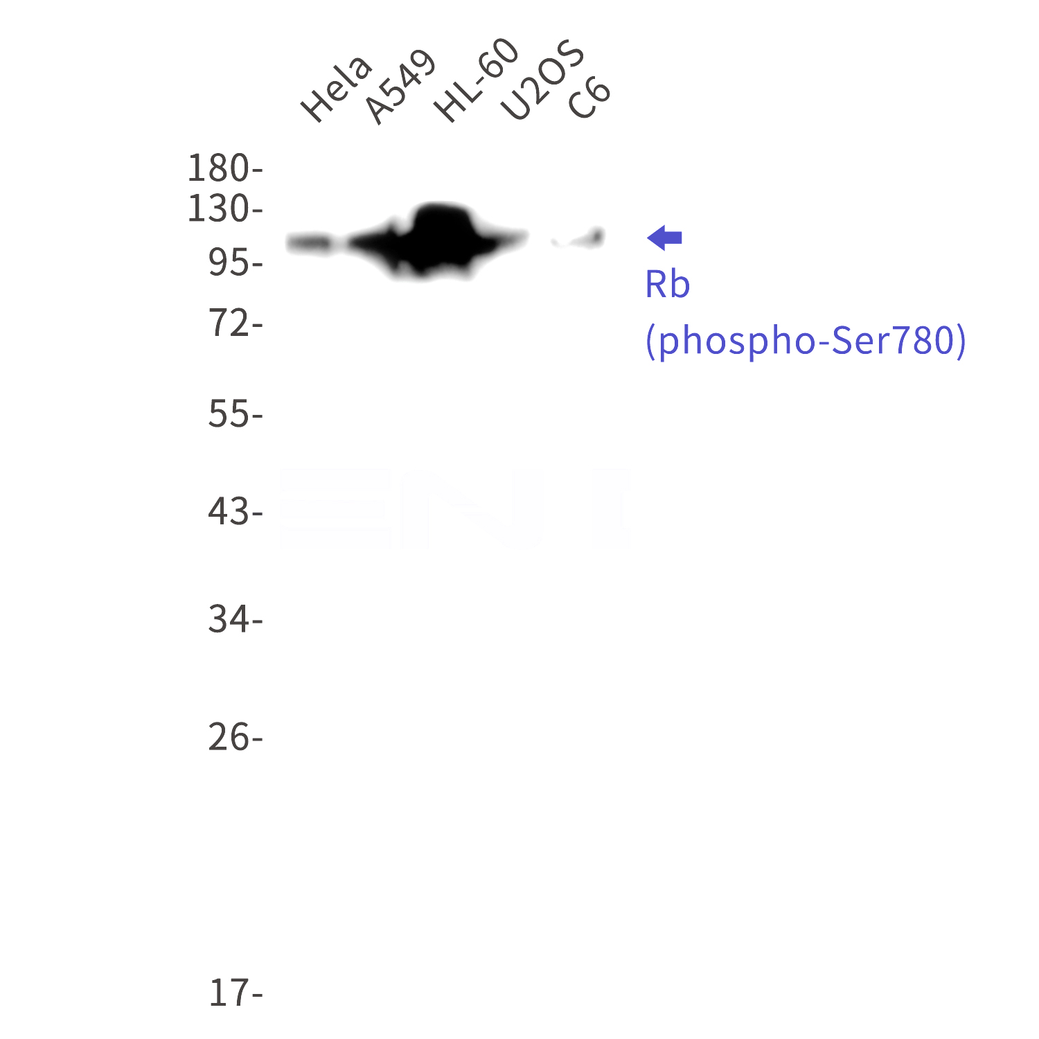 Western blot detection of Rb (phospho-Ser780) in Hela,A549,HL-60,U2OS,C6 cell lysates using Rb (phospho-Ser780) Rabbit mAb(1:1000 diluted).Predicted band size:106kDa.Observed band size:110kDa.