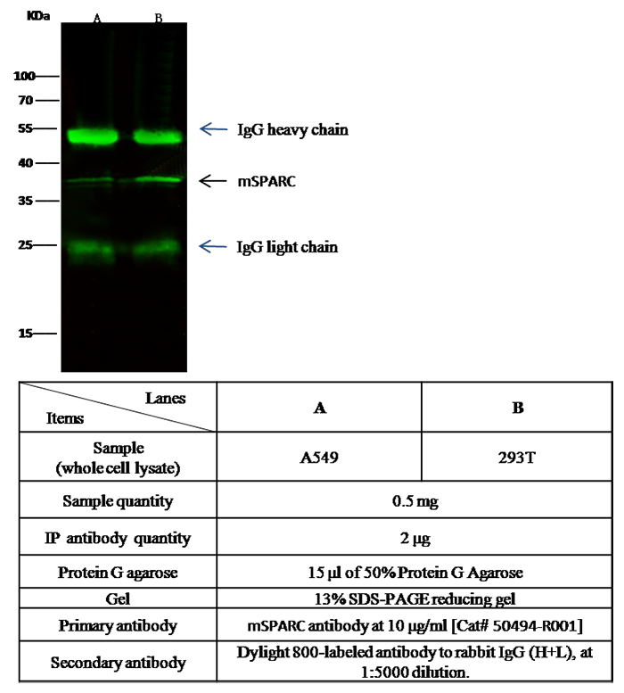 Osteonectin / SPARC Antibody, Rabbit MAb, Immunoprecipitation