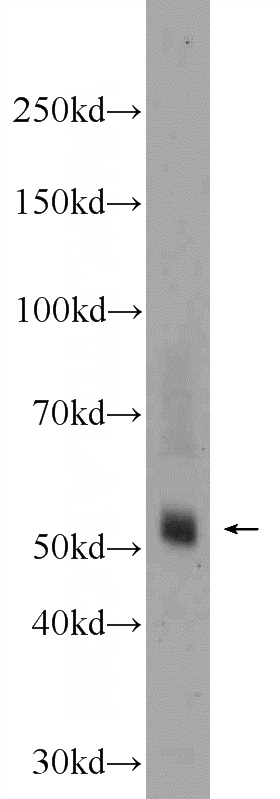 rat brain tissue were subjected to SDS PAGE followed by western blot with Catalog No:116277(TMPRSS5 Antibody) at dilution of 1:1000
