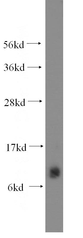 human skeletal muscle tissue were subjected to SDS PAGE followed by western blot with Catalog No:115401(SMPX antibody) at dilution of 1:400