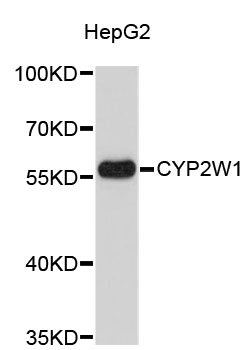 Western blot - CYP2W1 Polyclonal Antibody 
