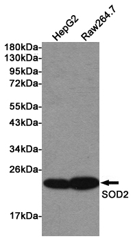 Western blot detection of SOD2 in HepG2 and Raw264.7 lysates using SOD2 Rabbit pAb (1:1000 diluted). Predicted band size: 25KDa. Observed band size:22KDa.