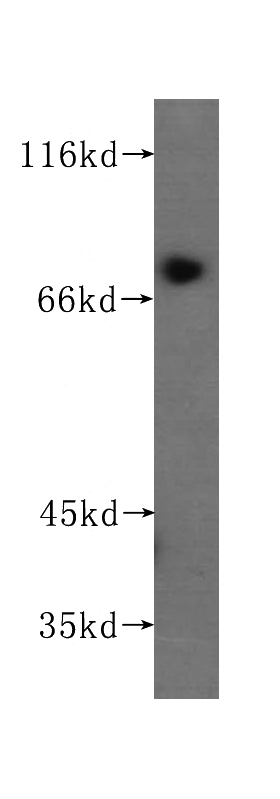 human placenta tissue were subjected to SDS PAGE followed by western blot with Catalog No:107477(PLOD3 antibody) at dilution of 1:300