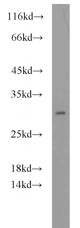 HepG2 cells were subjected to SDS PAGE followed by western blot with Catalog No:114177(PRDX4 antibody) at dilution of 1:800
