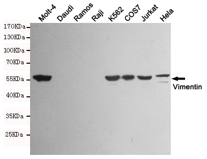 Western blot detection of Vimentin in Molt-4,K562,COS7,Jurkat,Hela and Vimentin negative cell (Daudi,Ramos,Raji) lysates using Vimentin mouse mAb (1:1000 diluted).Predicted band size:57KDa.Observed band size:57KDa.