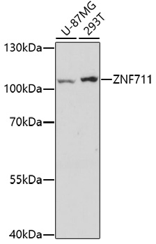 Western blot - ZNF711 Polyclonal Antibody 