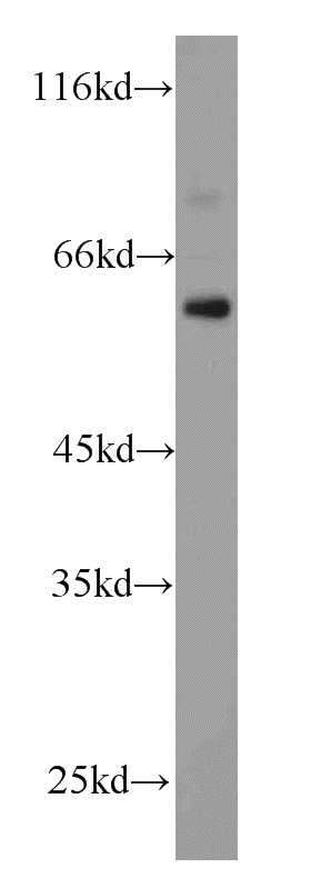 mouse heart tissue were subjected to SDS PAGE followed by western blot with Catalog No:115198(Serpina3k antibody) at dilution of 1:500