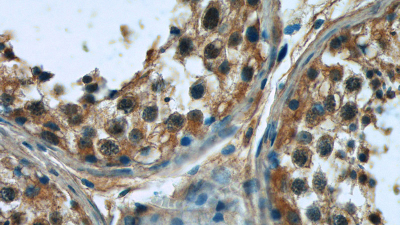 Immunohistochemistry of paraffin-embedded human testis tissue slide using Catalog No:115396(SMO Antibody) at dilution of 1:50 (under 40x lens)
