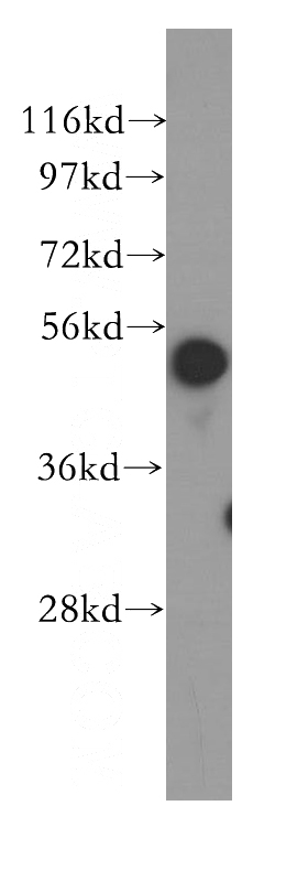 HeLa cells were subjected to SDS PAGE followed by western blot with Catalog No:111509(HNRNPK antibody) at dilution of 1:300
