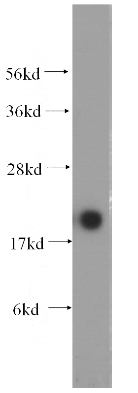 mouse skeletal muscle tissue were subjected to SDS PAGE followed by western blot with Catalog No:112941(MYL12B antibody) at dilution of 1:1000