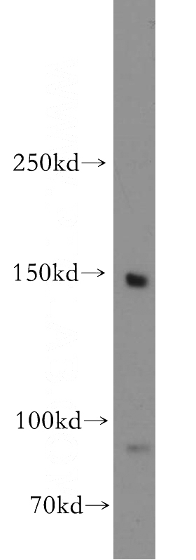human heart tissue were subjected to SDS PAGE followed by western blot with Catalog No:112914(MYBPC3 antibody) at dilution of 1:500