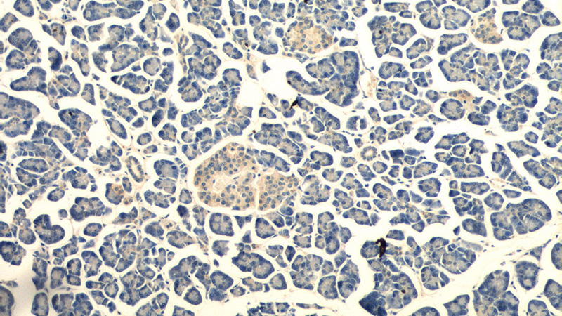 Immunohistochemistry of paraffin-embedded human pancreas tissue slide using Catalog No:110916(G-CSF Antibody) at dilution of 1:50 (under 10x lens)