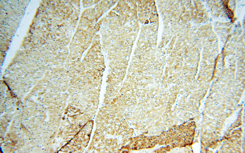 Immunohistochemical of paraffin-embedded human heart using Catalog No:116148(TNNC1 antibody) at dilution of 1:50 (under 10x lens)