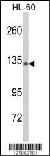 Western blot analysis of C5 Antibody (N-term) (Cat. #169130) in HL-60 cell line lysates (35ug/lane). C5 (arrow) was detected using the purified Pab.(2ug/ml)