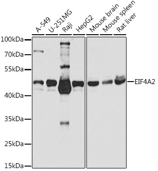 Western blot - EIF4A2 Polyclonal Antibody 