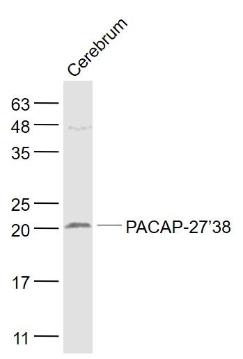 Fig1: Sample:; Cerebrum (Rat) Lysate at 40 ug; Primary: Anti- PACAP-27/38 at 1/1000 dilution; Secondary: IRDye800CW Goat Anti-Rabbit IgG at 1/20000 dilution; Predicted band size: 19 kD; Observed band size: 20 kD