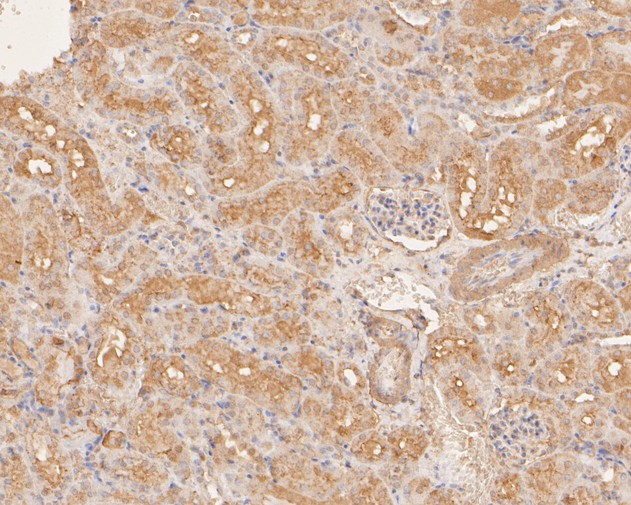 Fig5:; Immunohistochemical analysis of paraffin-embedded mouse kidney tissue using anti-DNA2 antibody. The section was pre-treated using heat mediated antigen retrieval with sodium citrate buffer (pH 6.0) for 20 minutes. The tissues were blocked in 5% BSA for 30 minutes at room temperature, washed with ddH; 2; O and PBS, and then probed with the primary antibody ( 1/400) for 30 minutes at room temperature. The detection was performed using an HRP conjugated compact polymer system. DAB was used as the chromogen. Tissues were counterstained with hematoxylin and mounted with DPX.