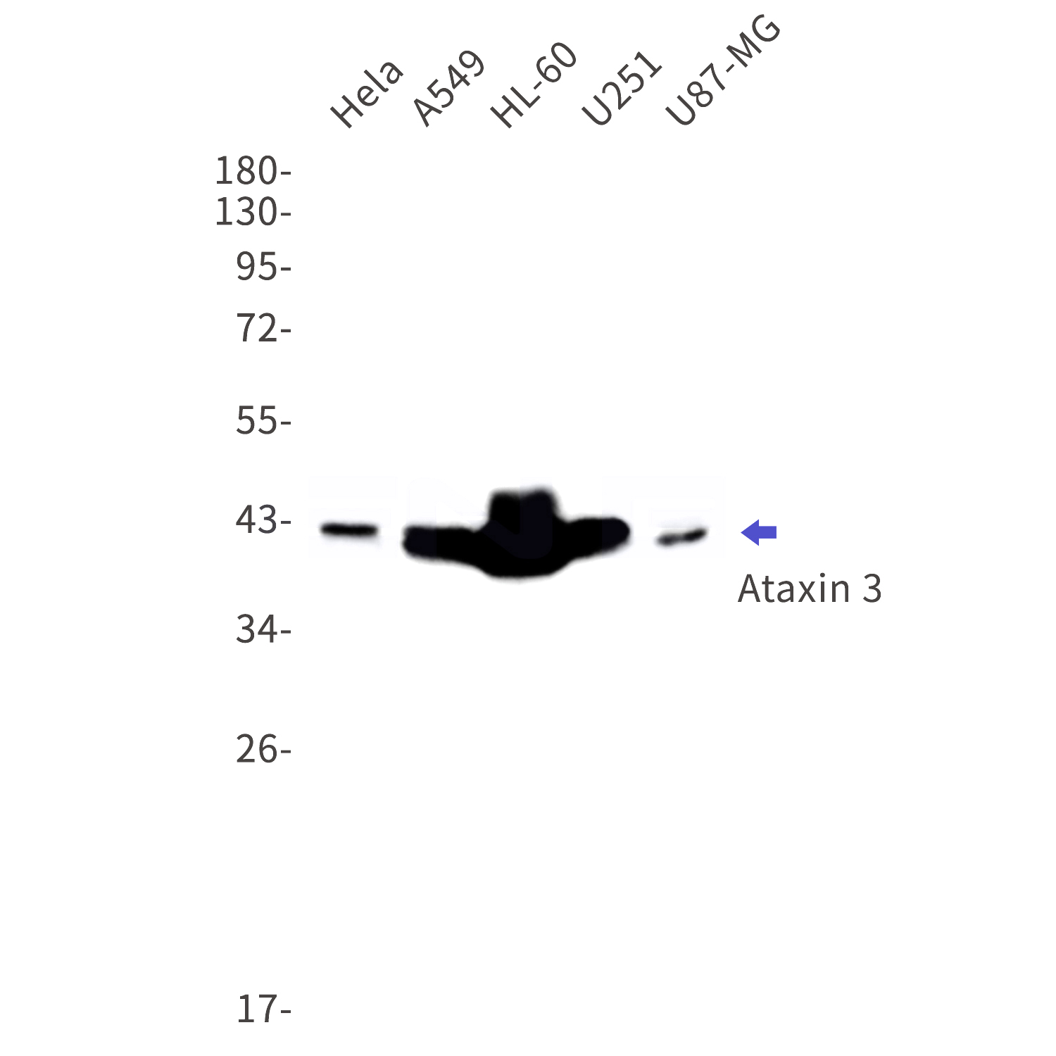 Western blot detection of Ataxin 3 in Hela,A549,HL-60,U251,U87-MG cell lysates using Ataxin 3 Rabbit mAb(1:1000 diluted).Predicted band size:42kDa.Observed band size:42kDa.
