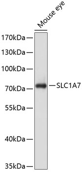 Western blot - SLC1A7 Polyclonal Antibody 