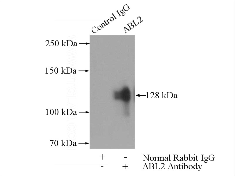 IP Result of anti-ABL2 (IP:Catalog No:107818, 4ug; Detection:Catalog No:107818 1:500) with HeLa cells lysate 1200ug.