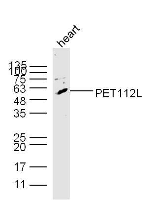 Fig2: Sample: Heart (Mouse) Lysate at 40 ug; Primary: Anti-PET112L at 1/300 dilution; Secondary: HRP conjugated Goat-Anti-rabbit IgG (bs-0295G-HRP) at 1/5000 dilution; Predicted band size: 58 kD; Observed band size: 58 kD