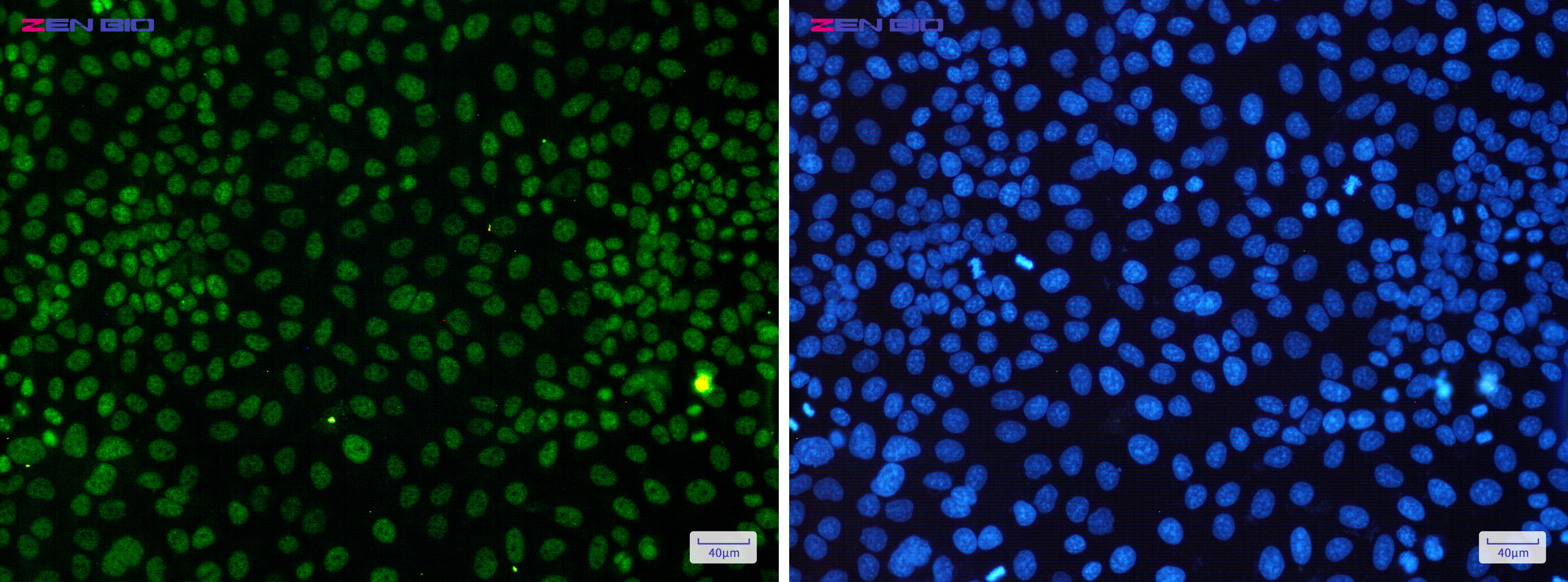 Immunocytochemistry of Cdk9(green) in Hela cells using Cdk9 Rabbit pAb at dilution 1/50, and DAPI(blue)