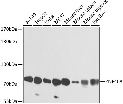 Western blot - ZNF408 Polyclonal Antibody 
