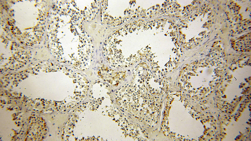 Immunohistochemical of paraffin-embedded human testis using Catalog No:109677(CYLC2 antibody) at dilution of 1:100 (under 10x lens)