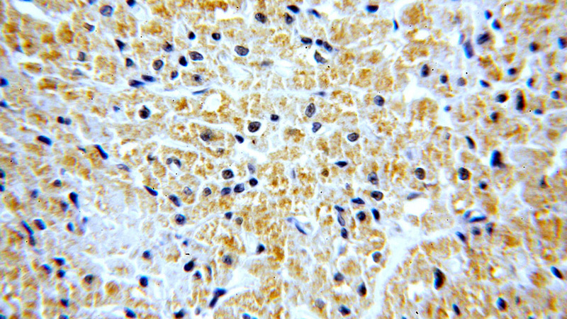 Immunohistochemical of paraffin-embedded human heart using Catalog No:115180(SH2D2A antibody) at dilution of 1:50 (under 40x lens)