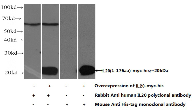 HEK-293 cells were subjected to SDS PAGE followed by western blot with Catalog No:111775(IL20 Antibody) at dilution of 1:700