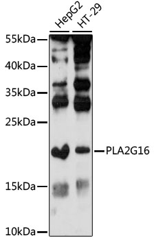Western blot - PLA2G16 Polyclonal Antibody 