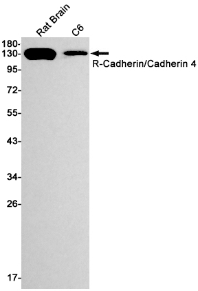 Western blot detection of R-Cadherin/Cadherin 4 in Rat Brain,C6 cell lysates using R-Cadherin/Cadherin 4 Rabbit mAb(1:1000 diluted).Predicted band size:100kDa.Observed band size:130kDa.