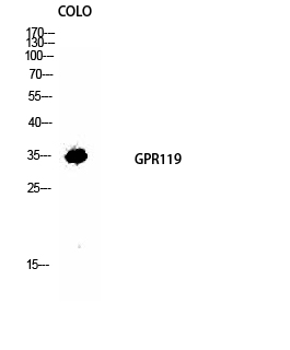 Fig1:; Western Blot analysis of COLO cells using GPR119 Polyclonal Antibody diluted at 1: 1000